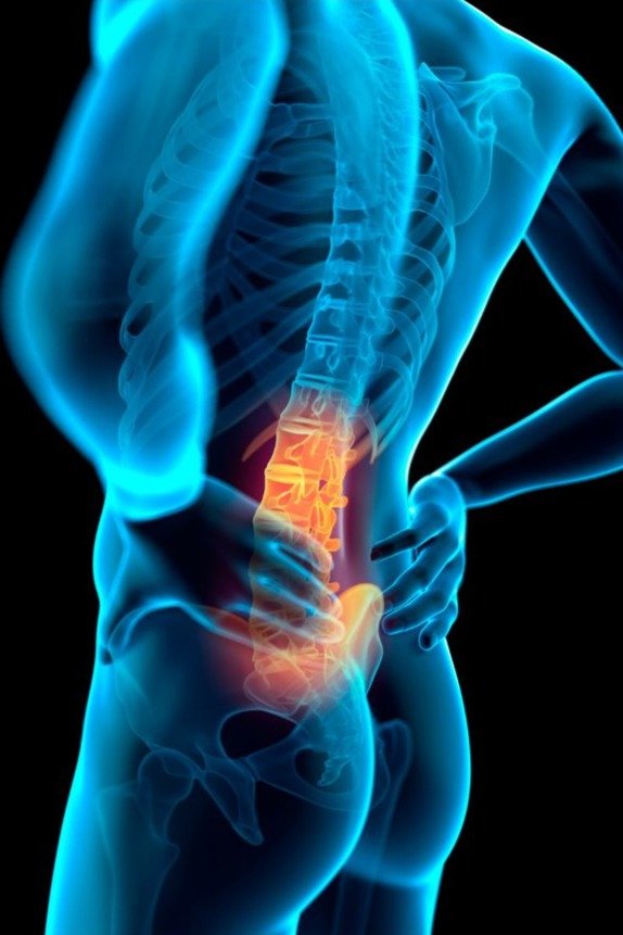 Inflammatory Back Pain
