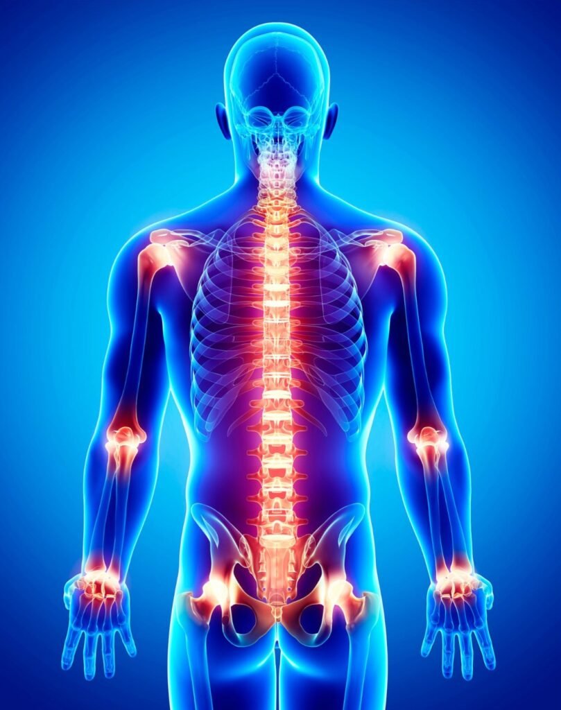 Inflammatory arthritis like Rheumatoid arthritis and ankylosing spondylitis and psoriatic arthritis can be healed reversed, resolved, put in remission with diet and lifestyle protocols.