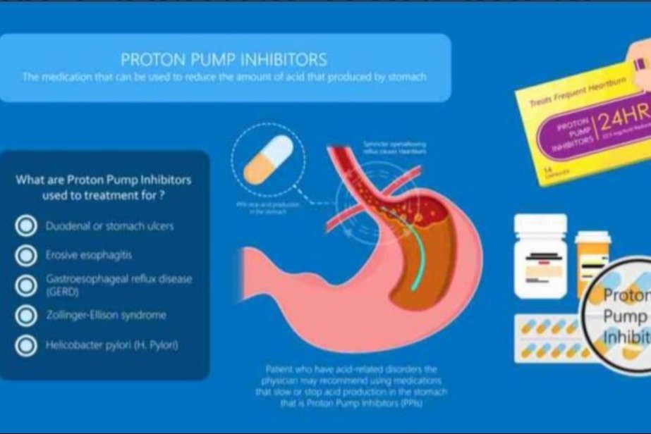 Proton Pump Inhibitors and arthritis, microbiome and Autoimmune disease.