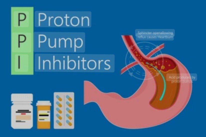 Proton Pump Inhibitors and Arthritis, Inflammation and the microbiome.