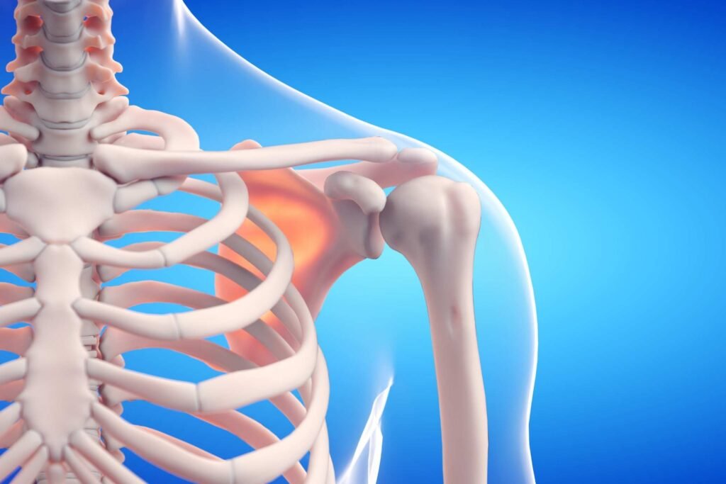 Bone health to prevent osteoarthritis