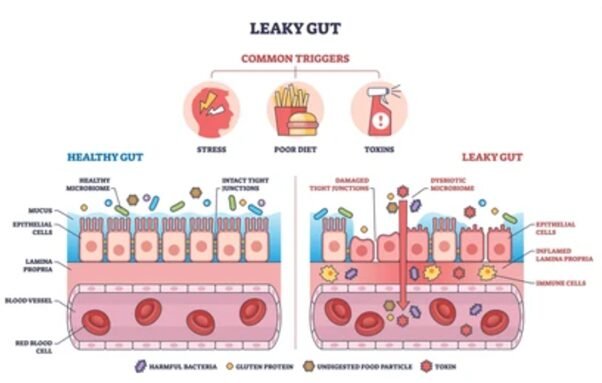 Tight Junctions and leaky gut - explaining how barrier systems relate to auto immunity and inflammatory diseases.